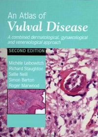 An Atlas of Vulval Diseases : A Combined Dermatological, Gynaecological and Venereological Approach - Michele Leibowitch