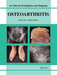 Oesteoarthritis : An Atlas of Investigation and Diagnosis - Adrian Jones