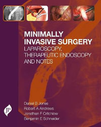 Minimally Invasive Surgery : Laparoscopy, Therapeutic Endoscopy and NOTES - Daniel  B Jones