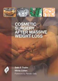 Cosmetic Surgery after Massive Weight Loss : JP MEDICAL - Mimis Cohen