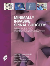 Minimally Invasive Spinal Surgery : Principles and Evidence-Based Practice - Kai-Uwe Lewandrowski