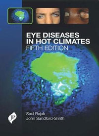 Eye Diseases in Hot Climates - Saul N Rajak