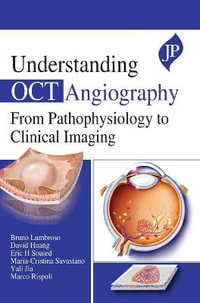 Understanding OCT Angiography : From Pathophysiology to Clinical Imaging - Bruno Lumbroso