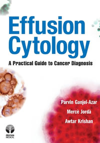 Effusion Cytology : A Practical Guide to Cancer Diagnosis - Parvin Ganjei-Azar