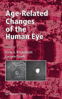 Age-Related Changes of the Human Eye : Aging Medicine - Carlo Cavallotti