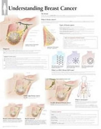 Understanding Breast Cancer Laminated Poster - Scientific Publishing