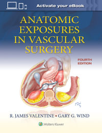 Anatomic Exposures in Vascular Surgery : 4th Edition - Wind Valentine