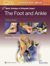 Master Techniques in Orthopaedic Surgery : The Foot and Ankle:   Print + eBook with Multimedia - Ellis