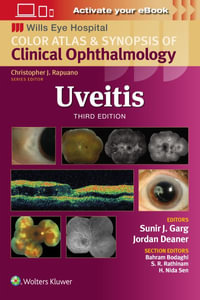 Uveitis : Wills Eye Institute Atlas Series - Garg