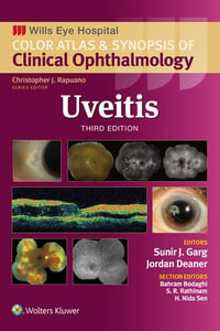 Uveitis : Wills Eye Institute Atlas Series - Sunir J. Garg
