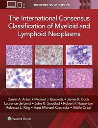 The International Consensus Classification of Myeloid and       Lymphoid Neoplasms - Arber