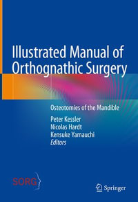 Illustrated Manual of Orthognathic Surgery : Osteotomies of the Mandible - Peter Kessler