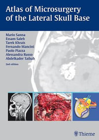 Atlas of Microsurgery of the Lateral Skull Base : THIEME PUBLISHERS - Mario Sanna