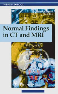 Normal Findings in CT and Mri, A1, Print : . Zus.-Arb.: Torsten B. Moller, Emil R. Reif 210 Illustrations - Torsten Bert Möller