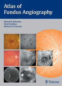 Atlas of Fundus Angiography : THIEME PUBLISHERS - Heinrich Heimann