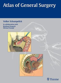 Atlas of General Surgery : THIEME PUBLISHERS - Volker Schumpelick