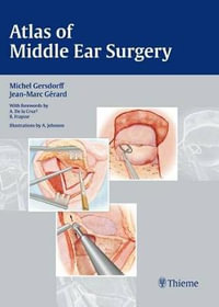 Atlas of Middle Ear Surgery : THIEME PUBLISHERS - Michel Gersdorff