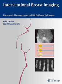 Interventional Breast Imaging : Ultrasound, Mammography, and MR Guidance Techniques - Uwe Fischer