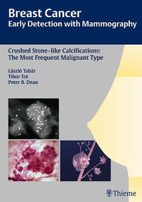 Breast Cancer: Early Detection with Mammography : Crushed Stone-like Calcifications: The Most Frequent Malignant Type - Laszlo Tabar