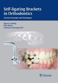 Self-Ligating Brackets in Orthodontics : Current Concepts and Techniques - Bjoern Ludwig