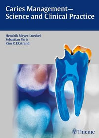 Caries Management - Science and Clinical Practice - Hendrik Meyer-Lueckel