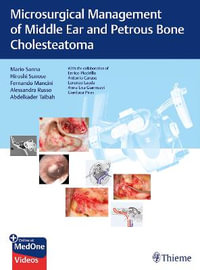 Microsurgical Management of Middle Ear and Petrous Bone Cholesteatoma - Mario Sanna