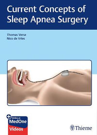 Current Concepts of Sleep Apnea Surgery - Thomas Verse