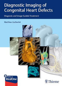 Diagnostic Imaging of Congenital Heart Defects : Diagnosis and Image-Guided Treatment - Matthias Gutberlet