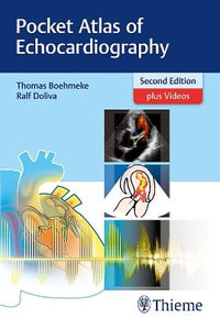 Pocket Atlas of Echocardiography : 2nd Edition plus Videos - Thomas Boehmeke