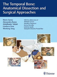 The Temporal Bone : Anatomical Dissection and Surgical Approaches - Mario Sanna