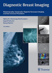 Diagnostic Breast Imaging : Mammography, Sonography, MRI and Interventional Procedures - Sylvia H. Heywang-Koebrunner