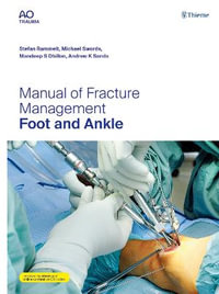 Manual of Fracture Management - Foot and Ankle - Stefan Rammelt