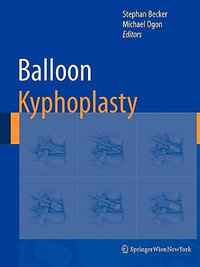 Balloon Kyphoplasty - Stephan Becker