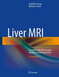 Liver MRI : Correlation with Other Imaging Modalities and Histopathology - Shahid M. Hussain