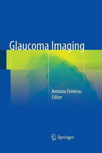 Glaucoma Imaging - Antonio Ferreras