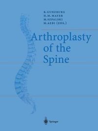 Arthroplasty of the Spine : European Spine Journal, V. 11, Suppl. 2 - Robert Gunzburg