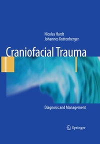 Craniofacial Trauma : Diagnosis and Management - Nicolas Hardt