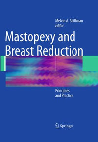 Mastopexy and Breast Reduction : Principles and Practice - Melvin A. Shiffman