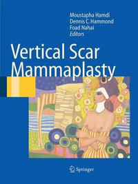 Vertical Scar Mammaplasty - Moustapha Hamdi