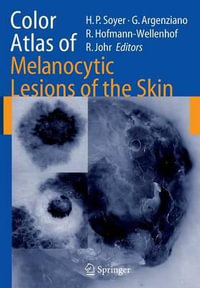 Color Atlas of Melanocytic Lesions of the Skin - H. Peter Soyer