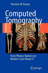 Computed Tomography : From Photon Statistics to Modern Cone-Beam CT - Thorsten M. Buzug