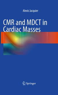 CMR and MDCT in Cardiac Masses - Alexis Jacquier