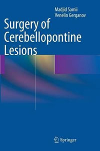 Surgery of Cerebellopontine Lesions - Madjid Samii