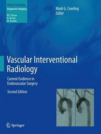 Vascular Interventional Radiology : Current Evidence in Endovascular Surgery - Mark G. Cowling