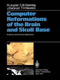 Computer Reformations of the Brain and Skull Base : Anatomy and Clinical Application - R. UnsÃ¶ld