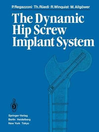 The Dynamic Hip Screw Implant System - P. Regazzoni