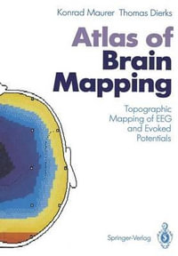 Atlas of Brain Mapping : Topographic Mapping of EEG and Evoked Potentials - Konrad Maurer