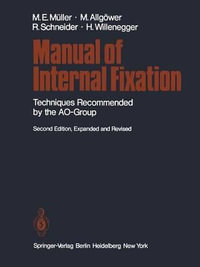 Manual of Internal Fixation : Techniques Recommended by the Ao Group - Maurice E. MÃ¼ller