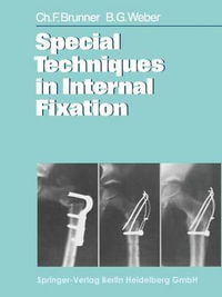 Special Techniques in Internal Fixation - C. F. Brunner