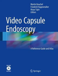 Video Capsule Endoscopy : A Reference Guide and Atlas - Martin Keuchel